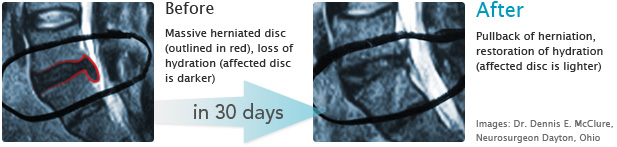 Before and After Disc Images